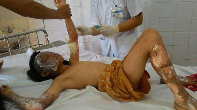 Trong số c&aacute;c nạn nh&acirc;n c&oacute; 3 trẻ em.