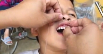 Nhổ răng cho con bằng xe máy, ông bố Ninh Bình khiến cư dân mạng cười ngất ngưởng