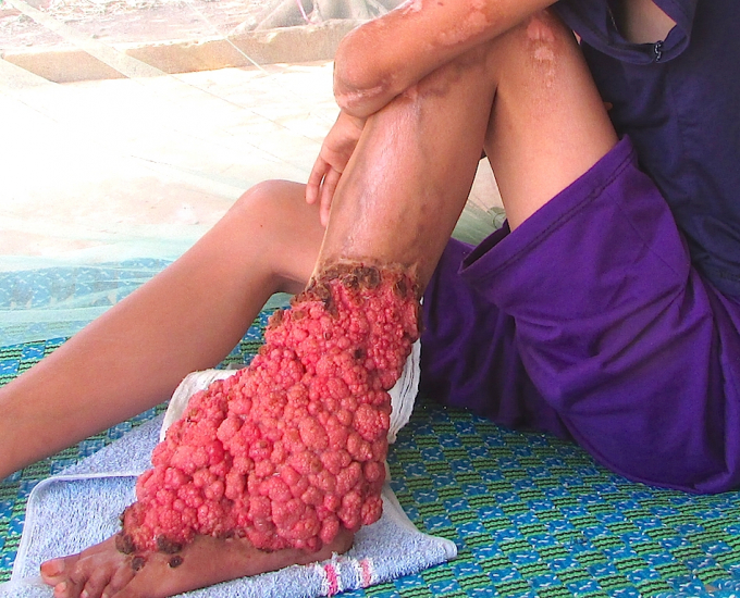 Đ&atilde; nhiều người giật m&igrave;nh khi nh&igrave;n thấy căn bệnh lạ m&agrave; Thanh mắc phải.