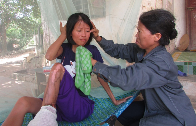 Hiện tại mọi sinh hoạt thường ng&agrave;y của Thanh đều nhờ v&agrave;o sự chăm s&oacute;c của người mẹ gi&agrave;.