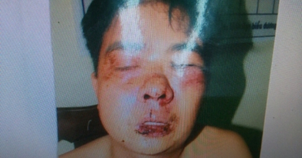 Kỳ 5 - Lâm Đồng: Bị cáo suy giảm sức khỏe nghiêm trọng, có dấu hiệu vi phạm tố tụng?