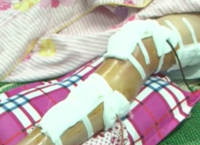 Vết thương của Trung &uacute;y Ho&agrave;ng Duy Th&agrave;nh qu&aacute; nặng phải đi bệnh viện cấp cứu tại bệnh vi&ecirc;n.