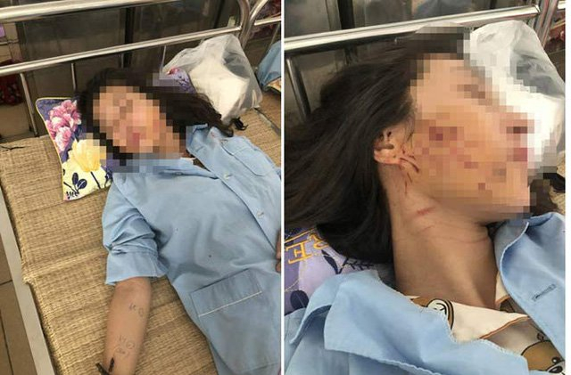 Chị G. đang điều trị tại Bệnh viện Đa khoa tỉnh Thanh H&oacute;a.