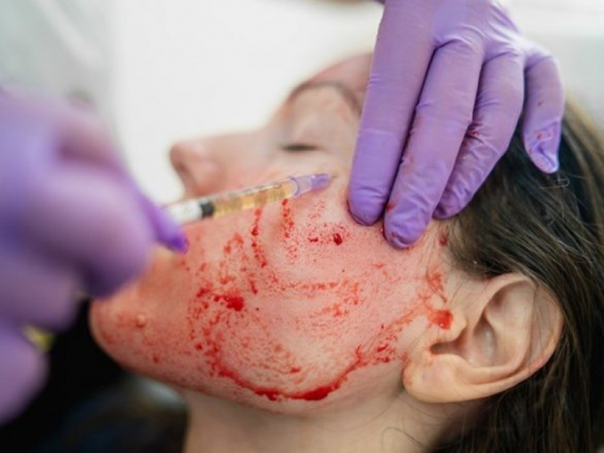 huyet tuong giau tieu cau