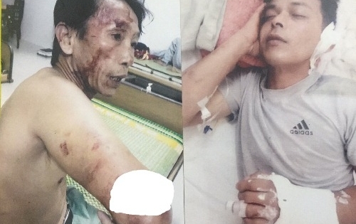 Hỗn chiến trong lúc giành quyền nuôi con sau ly hôn