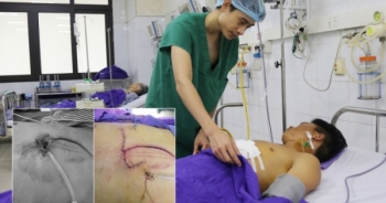 Cứu sống nam thanh niên sau tai nạn giao thông... lộ tim ra ngoài