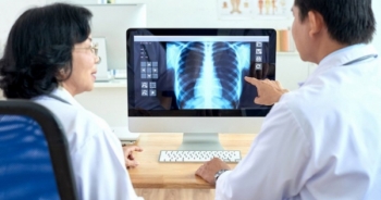 Tập đoàn Vingroup triển khai giải pháp AI-VINDR trong chẩn đoán hình ảnh Y tế