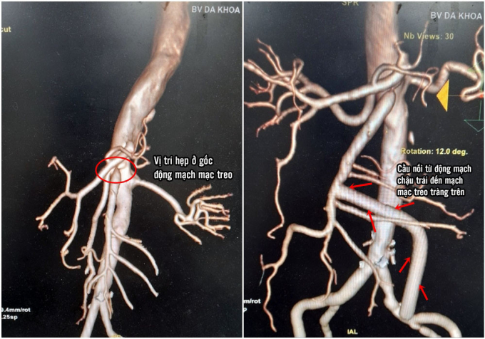 1848859_baccau_11345904