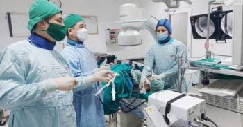 Nội soi gắp giun đũa dài gần 20cm trong ống mật chủ của bệnh nhi 11 tuổi