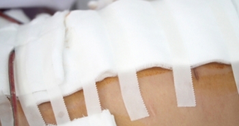 TP HCM: Lập tổ công tác xác minh vụ bệnh nhân thủng bụng sau khi hút mỡ