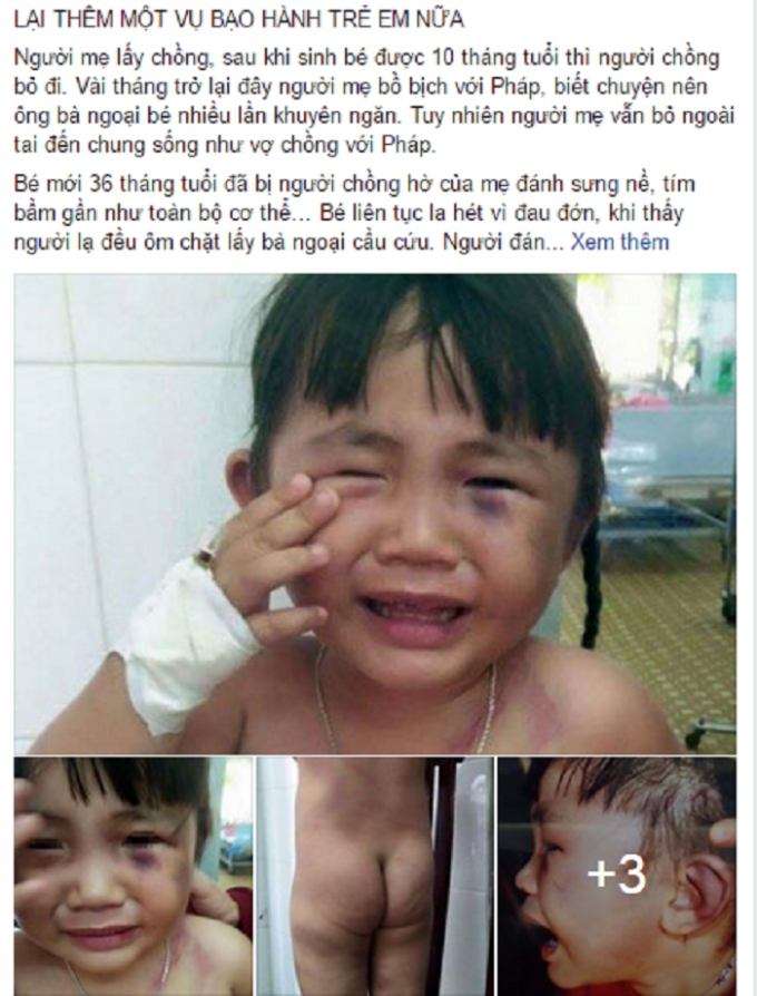 C&acirc;u chuyện về bạo h&agrave;nh trẻ em l&agrave;m d&acirc;n mạng phẫn nộ. (Nguồn: Facebook).