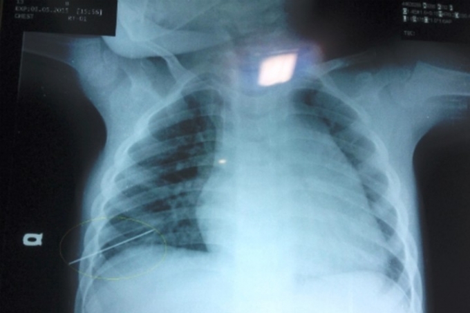 H&igrave;nh minh họa.