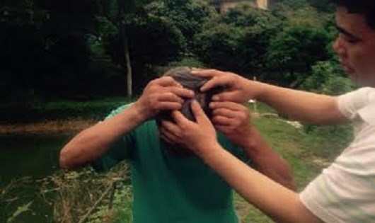 &Ocirc;ng Nhỡ bị thương ở đầu (tổn hại 5% sức khỏe) nhưng CQĐT kh&ocirc;ng t&igrave;m được thủ phạm.