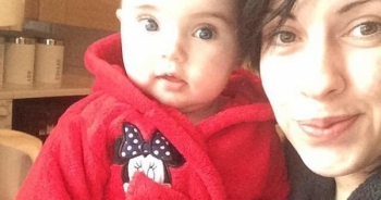 Mắc hội chứng nghiện ăn tóc: Bà mẹ nuốt hơn 6kg tóc vào bụng lúc ngủ