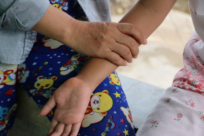 Bạc Li&ecirc;u: Kh&acirc;m phục nghị lực của c&ocirc; b&eacute; c&oacute; đ&ocirc;i tay bị khuyết tật