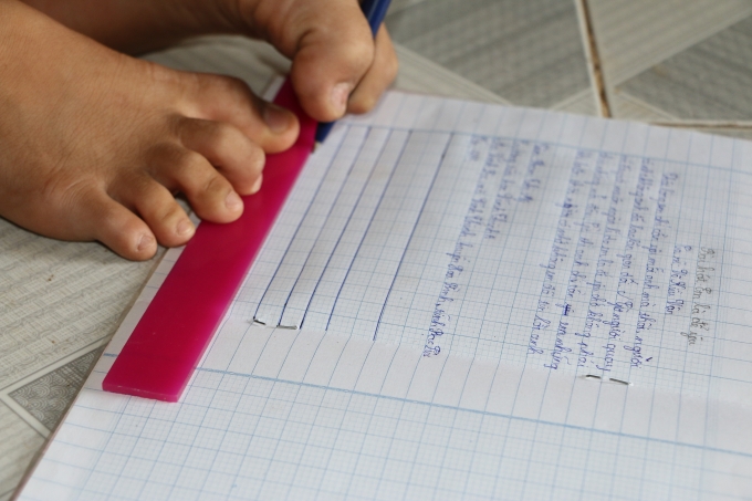 Bạc Li&ecirc;u: Kh&acirc;m phục nghị lực của c&ocirc; b&eacute; c&oacute; đ&ocirc;i tay bị khuyết tật