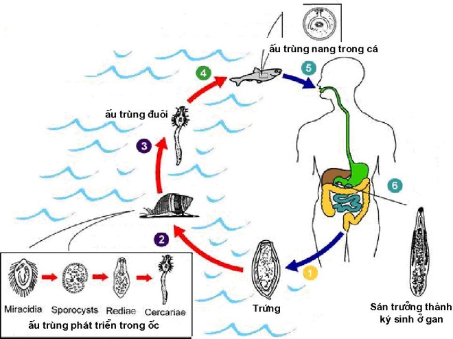 C&aacute;c chuy&ecirc;n gia về sức khỏe cho rằng s&aacute;n l&aacute; gan l&agrave; một loại bệnh k&yacute; sinh tr&ugrave;ng, được l&acirc;y truyền từ vật chủ l&agrave; t&ocirc;m, c&aacute;, ốc nước ngọt&hellip; (Ảnh: nguồn internet).