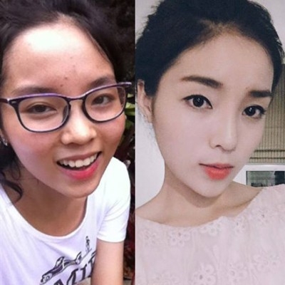 Kỳ Duy&ecirc;n bị cho l&agrave; đ&atilde; đụng dao k&eacute;o.