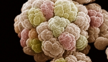 Siêu vi khuẩn ở Việt Nam, có thể giết chết bạn trong vòng 1 ngày