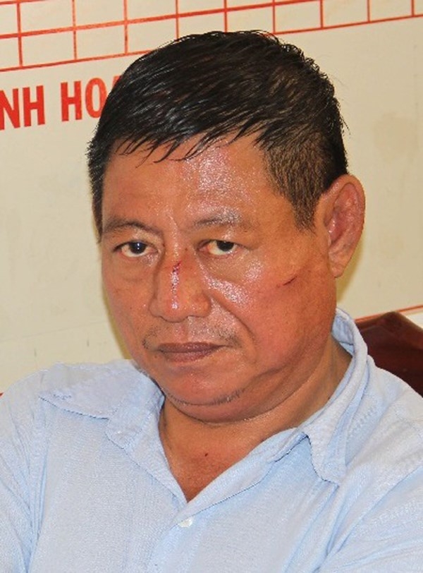 Trung t&aacute; Thi tại cơ quan điều tra.