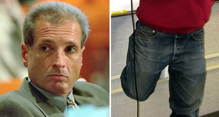 H&igrave;nh ảnh bệnh nh&acirc;n bị cắt nhầm ch&acirc;n phải chống nạng. Ảnh: Người đưa tin