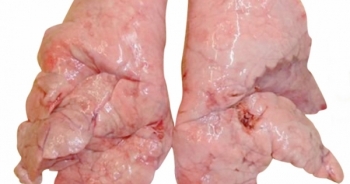 Công nghệ dùng phổi lợn lọc máu người