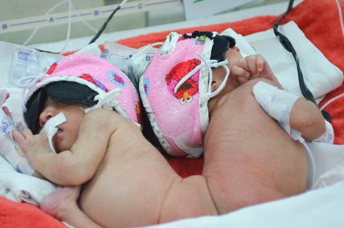 Dự kiến ng&agrave;y mai hoặc thứ 2 tuần sau (1/8) sẽ chụp MRI để khảo s&aacute;t th&ecirc;m c&oacute; tổn thương n&atilde;o hay kh&ocirc;ng v&agrave; khảo s&aacute;t th&ecirc;m c&aacute;c bất thường nơi cột sống, v&ugrave;ng chậu d&iacute;nh nhau.&nbsp;