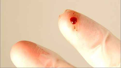 L&agrave;m g&igrave; khi c&oacute; nguy cơ phơi nhiễm HIV?