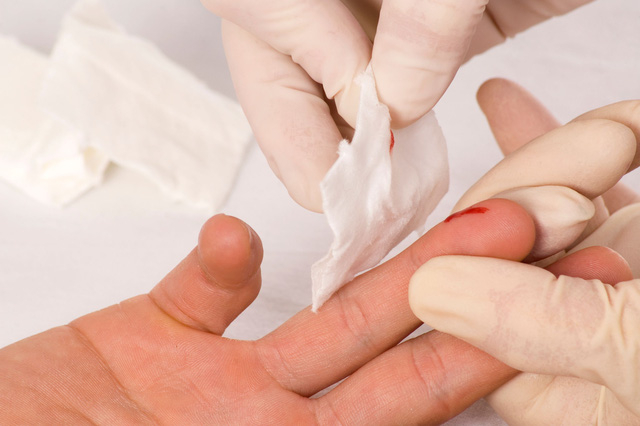 L&agrave;m g&igrave; khi c&oacute; nguy cơ phơi nhiễm HIV?