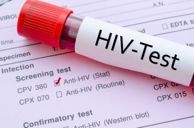 &nbsp;Cần nhanh ch&oacute;ng xử l&yacute; vết thương nghi phơi nhiễm HIV. Ảnh: minh họa