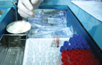 Vinamed thoái vốn không thông qua đấu giá?