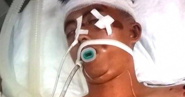 Tìm người thân khẩn cấp cho nam thanh niên nguy kịch sau tai nạn giao thông