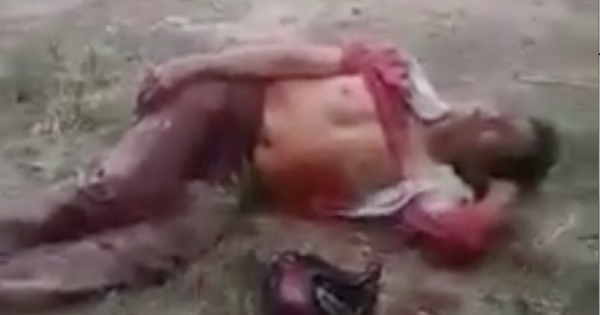 Cướp xe, đâm trọng thương tài xế xe ôm