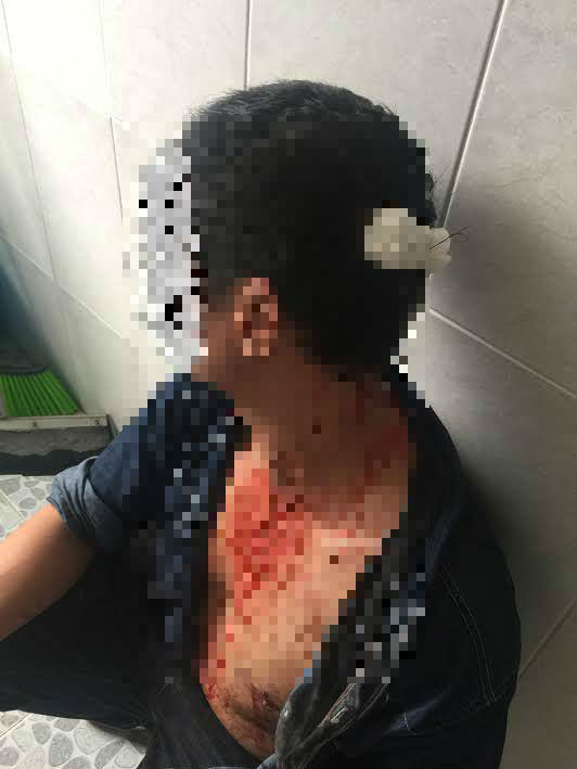 Anh T. bị h&agrave;nh hung phải nhập vi&ecirc;n điều trị tại BV Nh&acirc;n d&acirc;n 115.