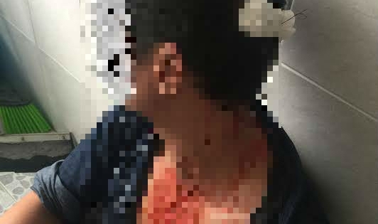 Kỳ 3 - Bệnh viện 115 đưa thiếu hồ sơ bệnh án để công an giám định thương tích?