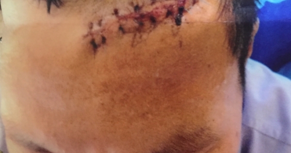 Quảng Ninh: Bỏ lọt tội và nương nhẹ cho hành vi côn đồ?