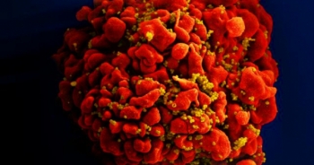 Em bé thứ ba trên thế giới được chữa khỏi HIV