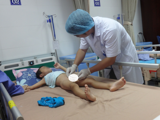 Một bệnh nhi đang điều trị s&ugrave;i m&agrave;o g&agrave; ở Bệnh Da liễu Trung ương ( Ảnh Ng.Nga)