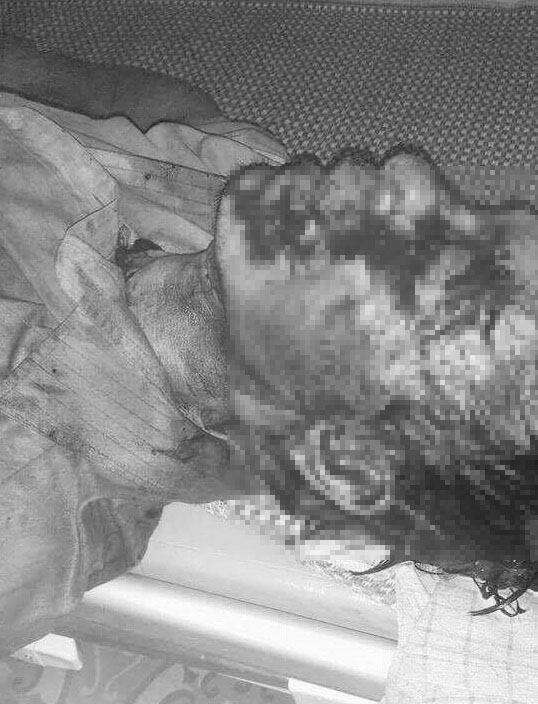 Nạn nh&acirc;n được đưa v&agrave;o viện trong t&igrave;nh trạng nguy kịch.