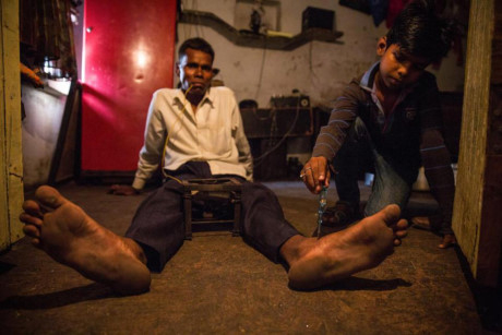 B&uacute;t thử điện cho thấy trong người &ocirc;ng c&oacute; d&ograve;ng điện chạy qua nhưng &ocirc;ng kh&ocirc;ng hề cảm thấy đau đớn.