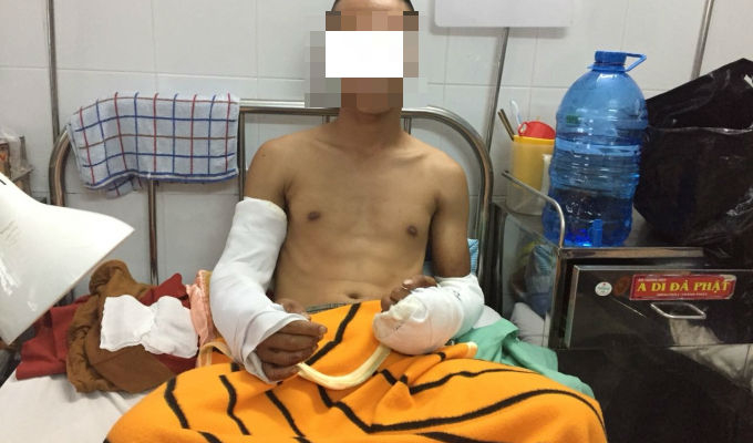 Nạn nh&acirc;n B&ugrave;i V. T. bị ch&eacute;m đứt g&acirc;n cả hai c&aacute;nh tay.