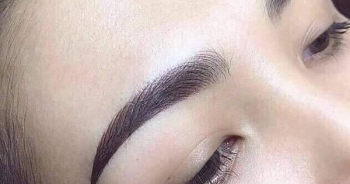 Nguyên ĐBQH tử vong sau làm đẹp: Lời khuyên "vàng" của bác sĩ thẩm mỹ