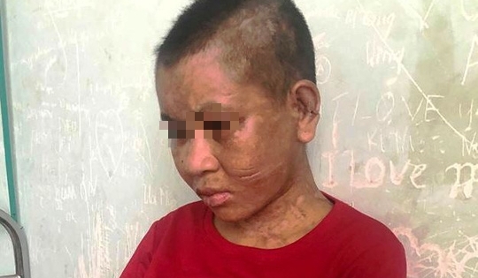 Đánh người làm thuê dã man ở Gia Lai: Quỷ thần cũng phải kinh hãi