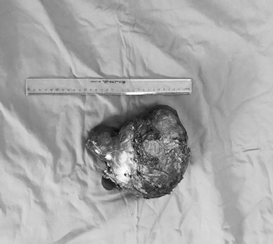 27.6.2019 BV K anh 3.