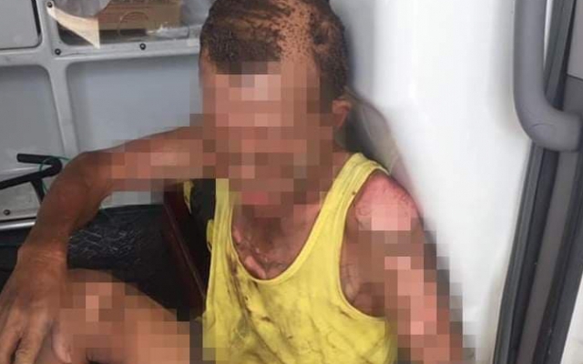 Đang ăn cơm trưa, con đổ xăng lên người bố đẻ rồi châm lửa cùng tự thiêu