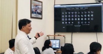 Thêm 18 giờ cứu não nhờ ứng dụng AI vào trong điều trị đột quỵ