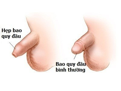 benh-hep-bao-quy-dau