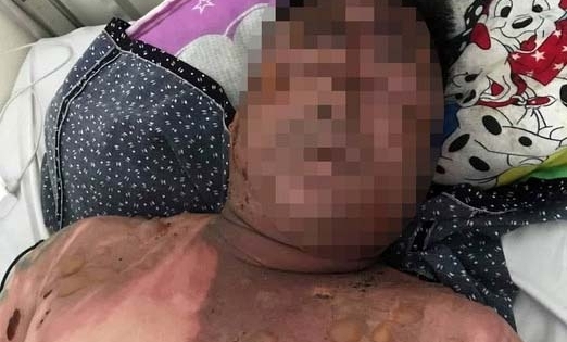 Nam thanh niên bất ngờ bị hất nồi lẩu vào mặt trong đám cưới