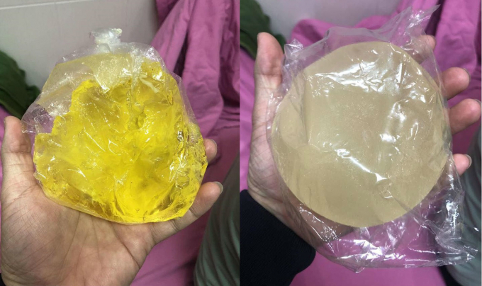 thanh-nu-bolero-dance-ivy-tran-no-tui-nguc-sau-7-nam-nang-nguc-3