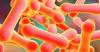 Phát hiện 3 bệnh nhân nhiễm vi khuẩn gây bệnh bạch hầu